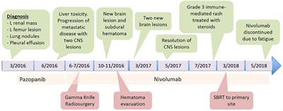 Radiation and Checkpoint Inhibitor Immunotherapy Lead to Long Term Disease Control in a Metastatic RCC patient With Brain Metastases